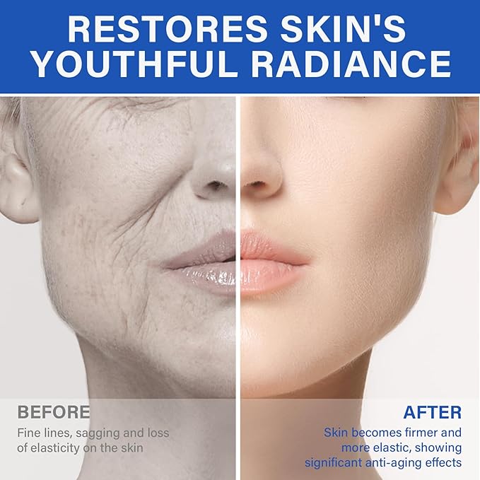 Salmon DNA Serum, 35ml Microneedling Serum for Wrinkles, Anti-Aging & Enhance Barrier Function