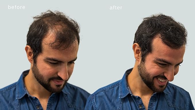 Volumizing Hair Fibers with real Keratin for Thinning Hair/Hair Loss – Dermatologist Tested and Certified Hypoallergenic - 60 days + supply - Multiple Colors Available (Black)