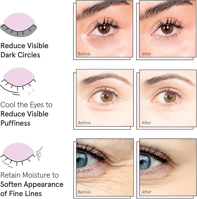 grace & stella Award Winning Under Eye Mask Reduce Dark Circles, Puffy Eyes, Undereye Bags, Wrinkles, Gel Under Eye Patches, New Mom Gifts - Vegan Self Care (48 Pairs, Blue)