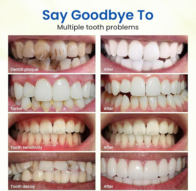 Teeth Whitening Powder, Toothpowder Fluoride-Free Hydroxyapatite Formula Enamel Strengthening Gently Cleans & Whitens