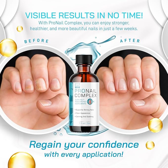 (2 Pack) Pronail Complex - Original Formula Toenail Treatment Pronail Complex Liquid Drops Premium Formula Extra Strength, Pro Nail Complex Oil Liquid Drop All Natural Support, 2 Bottles for 2 Months