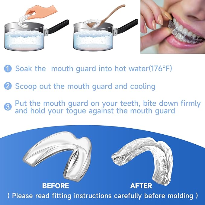 4 Pack Blue Mouth Guards for Women and Teens, Medium Size, Moldable Night Guards for Teeth Grinding and Clenching, Comfortable Bite Guards, Stylish Custom Dental Guards for Protection