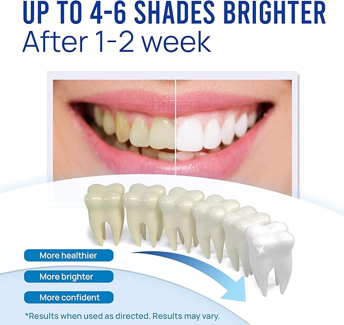 VieBeauti Teeth Whitening Pen (4 Pcs), 40+ Uses, Effective, Painless, No Sensitivity, Travel-Friendly, Easy to Use, Beautiful White Smile, Mint Flavor