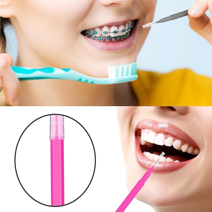 Patelai 100 Pieces Braces Brush for Cleaner Interdental Brush Toothpick Dental Tooth Flossing Head Oral Dental Hygiene Flosser Toothpick Cleaners Tooth Tool(Pink, Grey,Ideal Size)