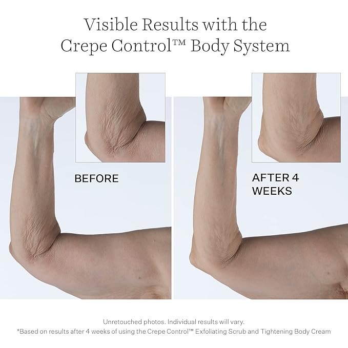 StriVectin Crepe Control Tightening Body Cream Jumbo, 10 oz, Body Cream for Hydration and Soft, Smooth Skin