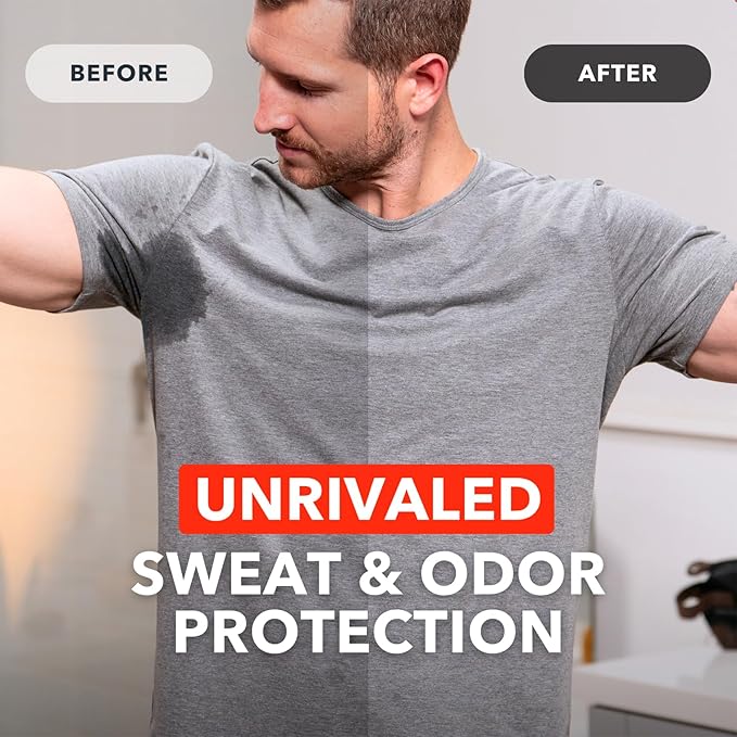 SweatBlock Clinical Strength Antiperspirant Wipes for Men Women Excessive Sweat Protection Hyperhidrosis Treatment Stops Underarm Perspiration Up to 7 Days Includes 10 Individually Wrapped Sweat Wipes