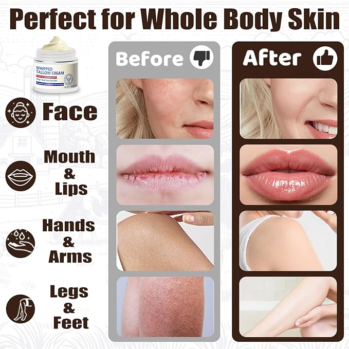 Beef Tallow for Skin, Natural Beef Tallow for Face, 100% Organic Grass Fed Finished Whipped Tallow and Honey Balm, Tallow Cream for Skin Care, Tallow Face Moisturizer Body Lotion
