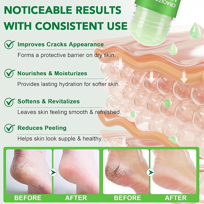 Urea Cream Foot Callus Remover Stick - 60% Urea with 2% Salicylic Acid, Professional Strength Moisturizer for Dry Cracked Feet, Heels, Knees, Elbows & Hands, Callus Removal & Skin Softening