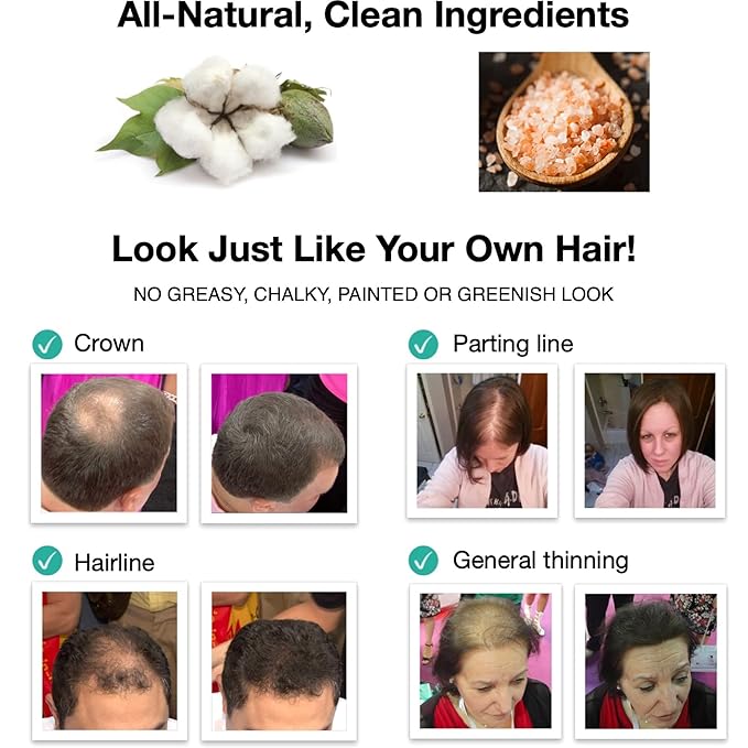 Caboki Hair Loss Concealer. All-Natural Hair Building Fiber. Make Thin Hair Look 10X Fuller Instantly. Eliminate the Appearance of Bald Spot and Thinning Hair (30G, 90-Day Supply). Salt & Pepper-Dark