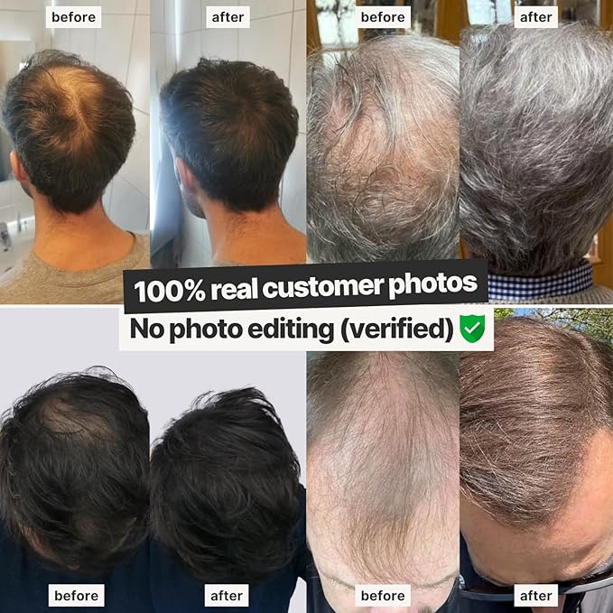 IMPERIO Hair Building Fibers for Thinning Hair - 26g Premium Hair Fibers for Women & Men - Dark Brown