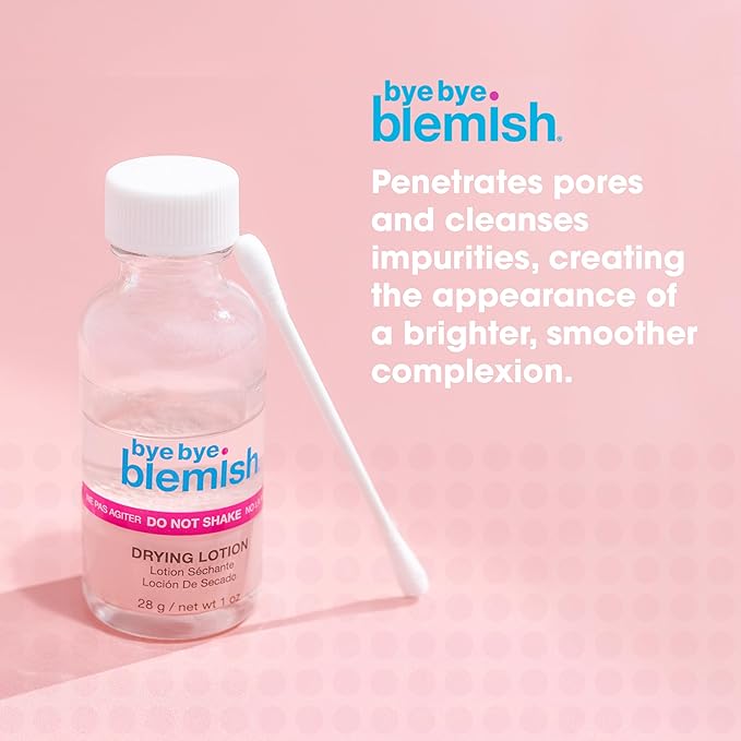Bye Bye Blemish Acne Drying Lotion, Reduce Pimples Overnight 1oz, 1-Pack