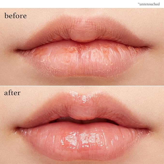 NOONI Vegan Applebutter Lip Mask Overnight – Hydrating Lip Balm & Butter with Shea Butter & Vitamins | Soothing Moisturizer, Softening Treatment for Dry Lips, Stocking Stuffers, 0.42 oz