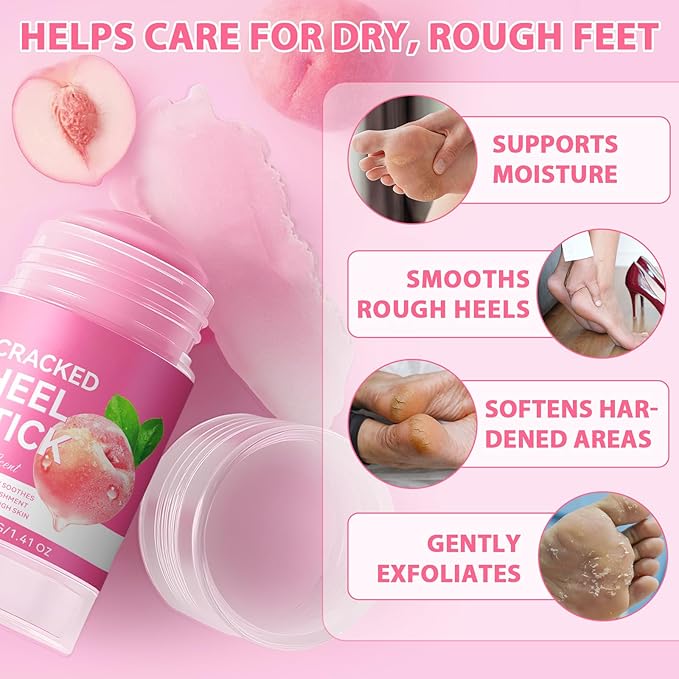 Urea Cream Foot Callus Remover Stick - 60% Urea with 2% Salicylic Acid, Professional Strength Moisturizer for Dry Cracked Feet, Heels, Knees, Elbows & Hands, Callus Removal & Skin Softening Treatment