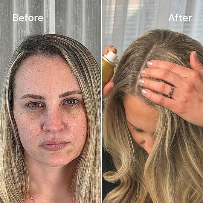 Style Edit MEDIUM BLONDE Root Concealer Touch Up Spray | Instantly Covers Grey Roots | Professional Salon Quality Cover Up Hair Products for Women |4 Ounce (Pack of 1)