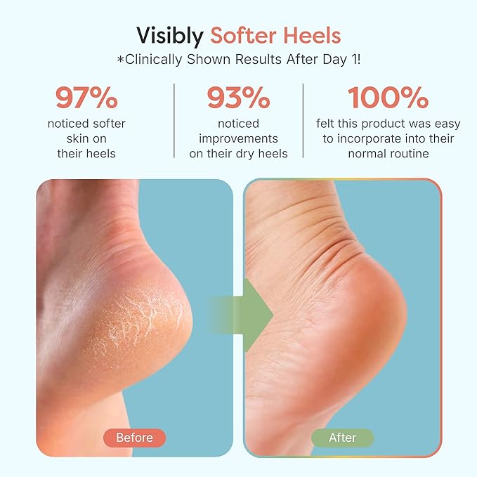 ZenToes Moisturizing Socks for Cracked Heel Treatment, Vitamin E, Olive Oil and Jojoba Oil Heel Socks, Stocking Stuffers for Women, Spa Self Care Gifts for Women (Fuzzy Blue, Wide Width)