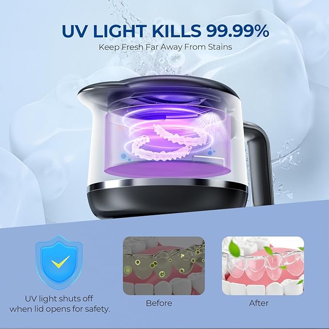 Dental Ultrasonic Retainer Cleaner Machine: Dental Cleaning Pod for Denture/Mouth Guard/Aligner/Night Guard/Braces/Toothbrush Heads/Jewelry - 45kHz Retainer Cleaner with Digital Timer & 200ML