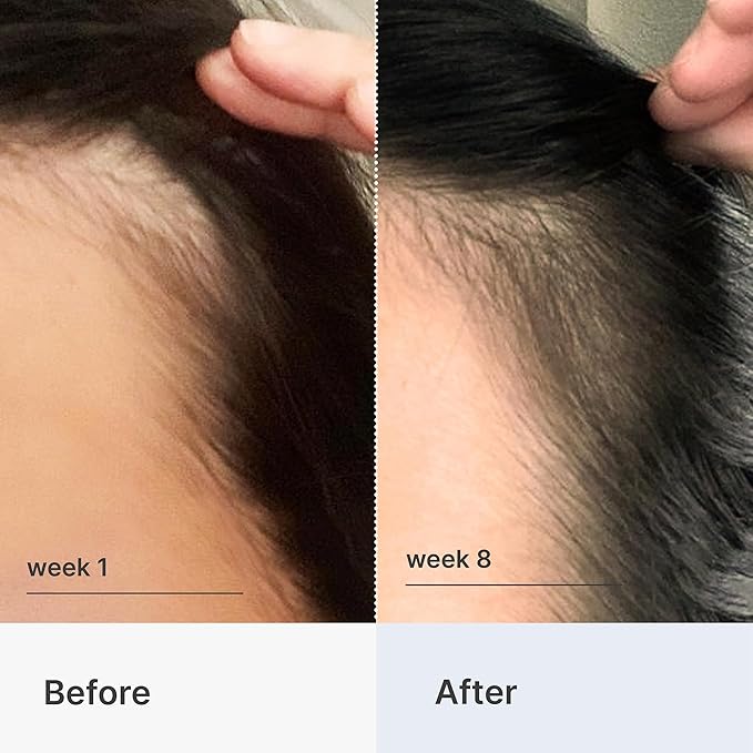 Better Not Younger Hair Thickening Serum for Women Over 40 – Scalp Care, Hair Density Treatment and Anti-Aging 2fl.oz – Fortifying Serum with Biotin & Ginger. Promotes Stronger, Thicker-Looking Hair.