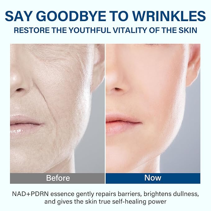NADH+ PDRN Serum, Collagen Peptides Facial Serum for Reduce Wrinkles & Fine Lines, Anti-Aging & Improve Dullness