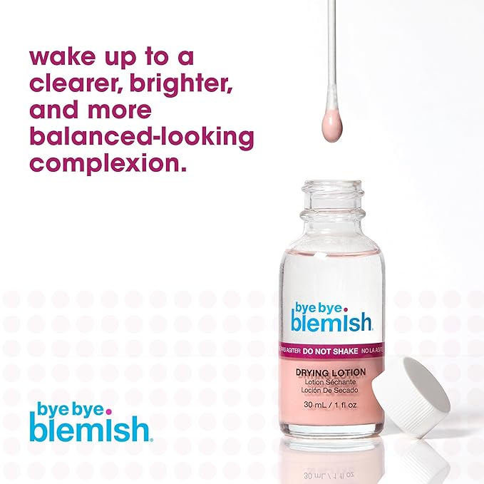 Bye Bye Blemish Acne Drying Lotion, Reduce Pimples Overnight 1oz, 1-Pack