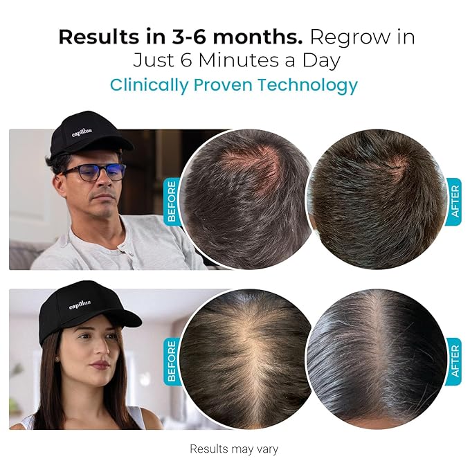 Capillus SPECTRUM Red Light Therapy Cap, Red Light Hat, 312 Laser Hair Growth Cap, Red Light Cap For Hair Regrowth, Near Infrared Red Light Therapy For Hair Growth, LLLT +Bluetooth Battery