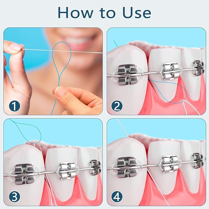 Floss Threaders Dental Floss Threader for Braces Bridges 400PCS(4Pack)