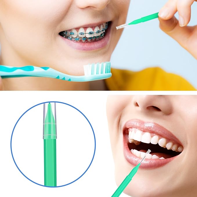 Patelai 100 Pieces Braces Brush for Cleaner Interdental Brush Toothpick Dental Tooth Flossing Head Oral Dental Hygiene Flosser Toothpick Cleaners Tooth Tool(Green, Yellow,Mixed Sizes)