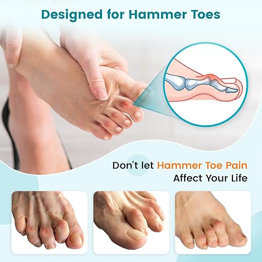 Hammer Toe Straightener Corrector Splint Brace for Women fit 2nd 3rd and 4th Toes - (M-Black) - 1 Pair