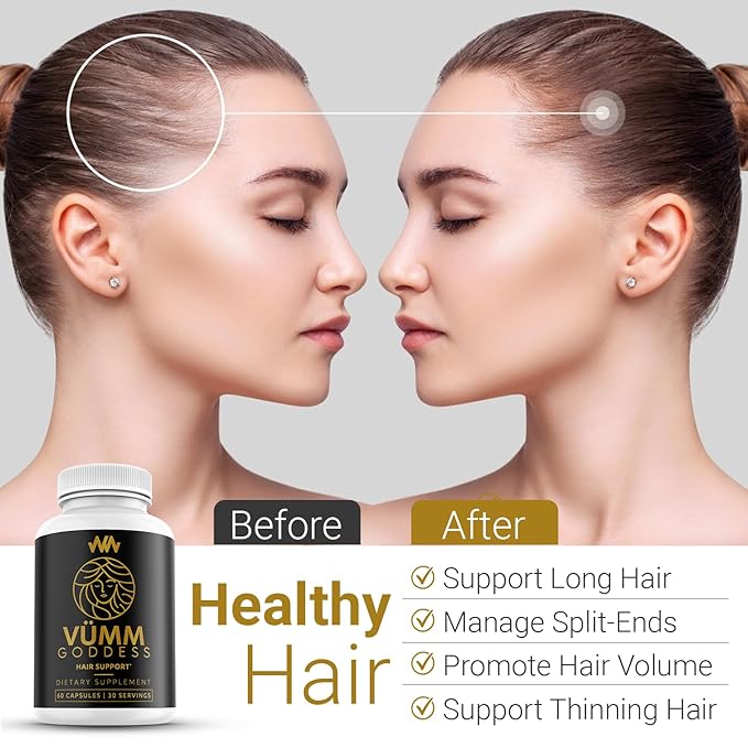 Womens Hair Growth Supplement | Thicker Fuller Hair Support for Thinning Hair and Hair Loss Vitamins | Warped Wellness Vümm Goddess