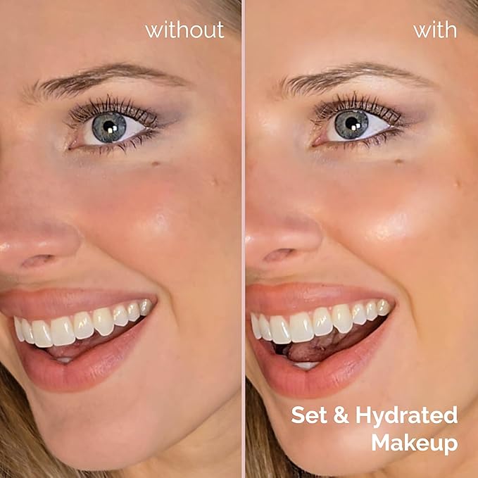 Elizabeth Mott Thank Me Later 3-in-1 Dewy Makeup Setting Spray - Hydrating & Long-Lasting Fine Mist with Niacinamide for Radiant, Glowy Skin - Lightweight, Oil-Free & Cruelty-Free Formula, 95 mL