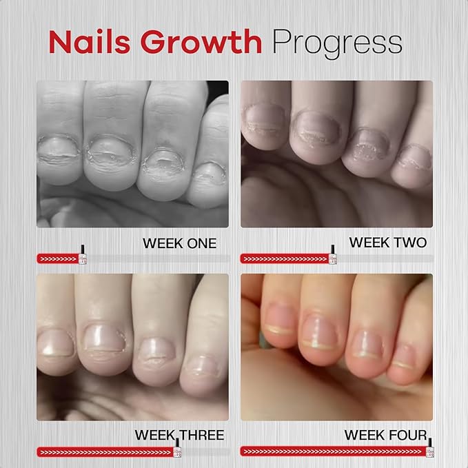 Nail Biting Prevention For Kids: Nail Biting Treatment Anti Toddler Thumb Sucking Deterrent Stopper Nail Polish Nail Repair for Damaged Nails Safe Lasting Growth Strengthener Care