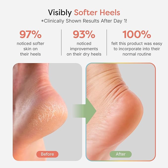 ZenToes Moisturizing Socks for Cracked Heel Treatment, Vitamin E, Olive Oil and Jojoba Oil Heel Socks, Stocking Stuffers for Women, Spa Self Care Gifts for Women (Fuzzy Black, Regular)