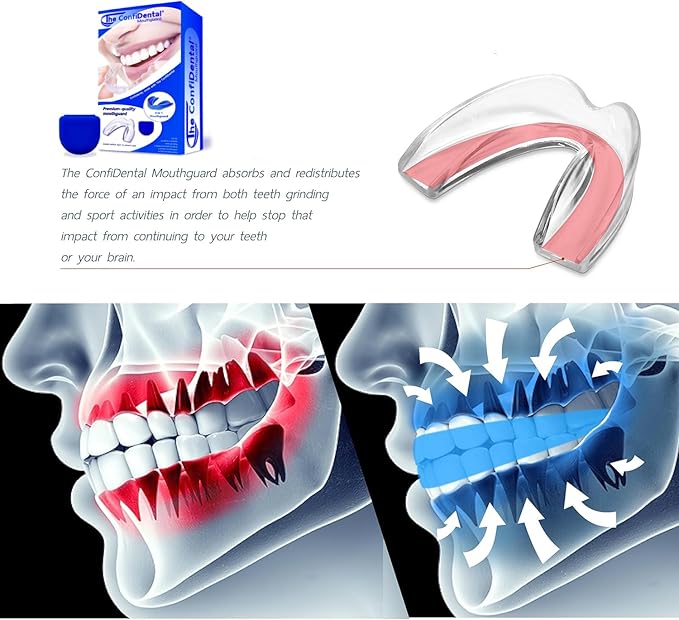 The ConfiDental Mouth Guard for Grinding Teeth at Night - 3 Models Pack of 6 Moldable Dental Night Guards for Teeth Grinding and Clenching Teeth Grinding Mouth Guard for Sleep