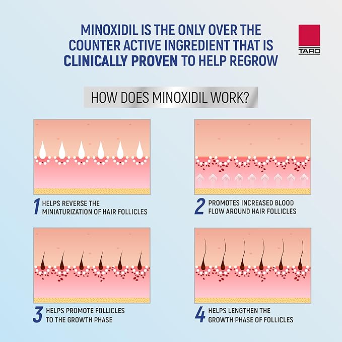 Minoxidil for Men, 2.11 Oz (1 Month Supply) Clinically Proven to Regrow Hair, Topical Aerosol Foam 5%, Hair Thinning Treatment