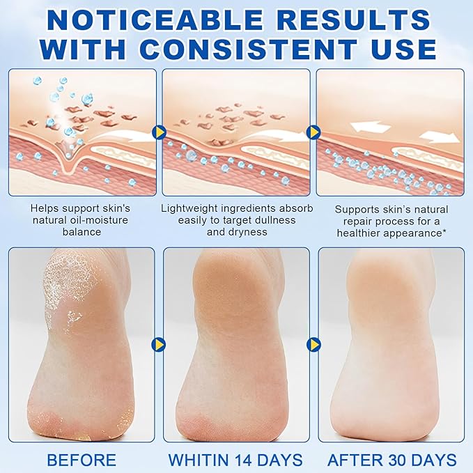 60% Urea with 2% Salicylic Acid Foot Care Stick, Hydrating Repairs Feet Cream, Foot Lotion Moisturizer for Dry Cracked Feet, Elbows, Hands (1.41 Ounce (Pack of 1))