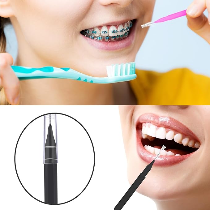 Patelai 100 Pieces Braces Brush for Cleaner Interdental Brush Toothpick Dental Tooth Flossing Head Oral Dental Hygiene Flosser Toothpick Cleaners Tooth Tool(White, Black, Pink,Proper Size)
