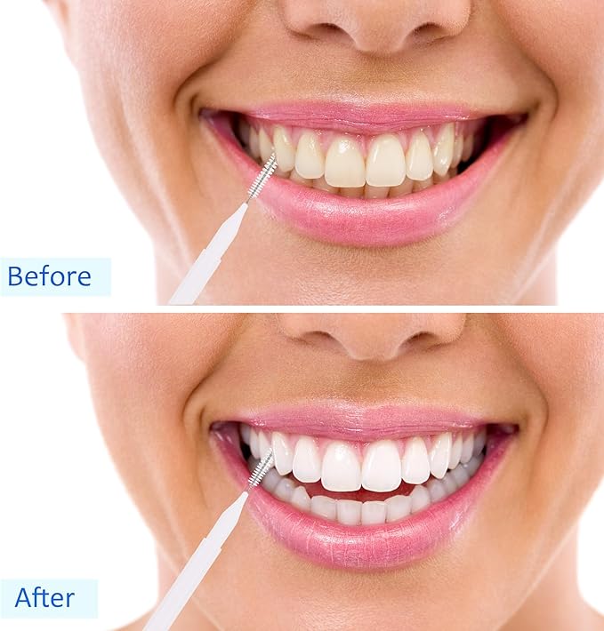 Patelai 100 Pieces Braces Brush for Cleaner Interdental Brush Toothpick Dental Tooth Flossing Head Oral Dental Hygiene Flosser Toothpick Cleaners Tooth Tool(White, Light Pink,Multiple Sizes)