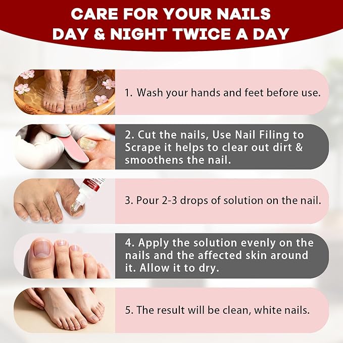 Toenail Treatment,Gentle Formula, Effectively Improves Nails for a More Beautiful Appearance (1Pcs, 1 oz)