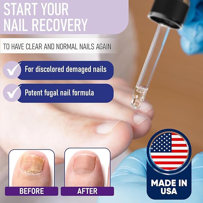 Zanaquick Extra Strength Toenail & Fingernail Repair Drops - Nail Care Renewal for Thick, Damaged & Discolored Nails - 1 Pack