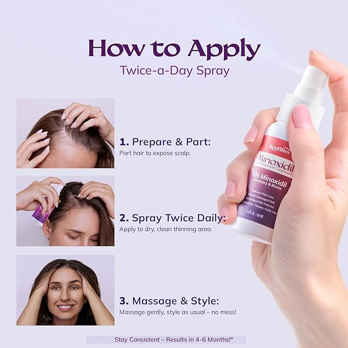 5% Minoxidil Spray for Women Hair Growth: RootStim Extra Strength Hair Regrowth Treatment with Rosemary & Biotin for Thinning Hair, Fuller & Healthier Hair - 2 Fl Oz