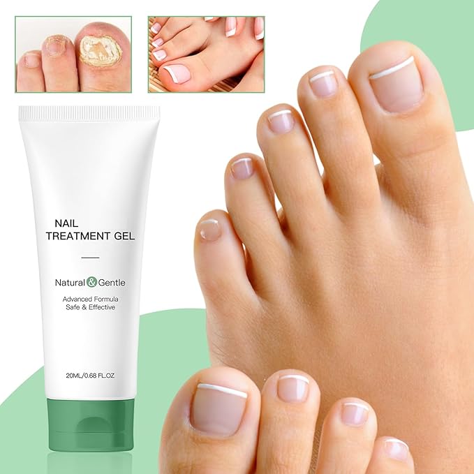 2Pcs Natural Nail Repair Gel, Nail Growth Repair Cream, Multi Purpose Nail Repair Foot Care Cream.