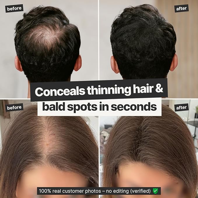 IMPERIO Hair Building Fibers for Thinning Hair - 26g Premium Hair Fibers for Women & Men in Hairdresser Quality - Hair thickening in less than 20 seconds (Light Blonde)