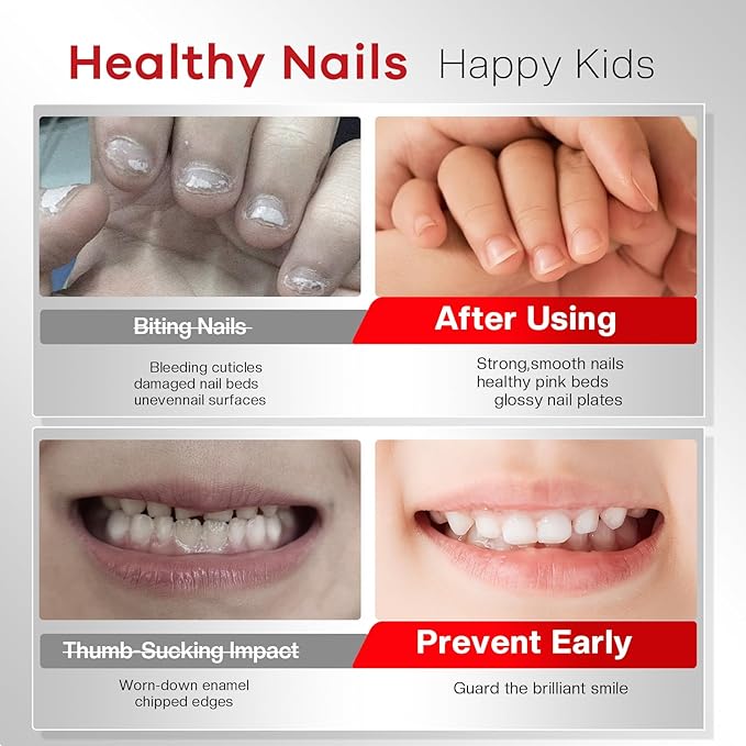 Nail Biting Prevention For Kids: Nail Biting Treatment Anti Toddler Thumb Sucking Deterrent Stopper Nail Polish Nail Repair for Damaged Nails Safe Lasting Growth Strengthener Care