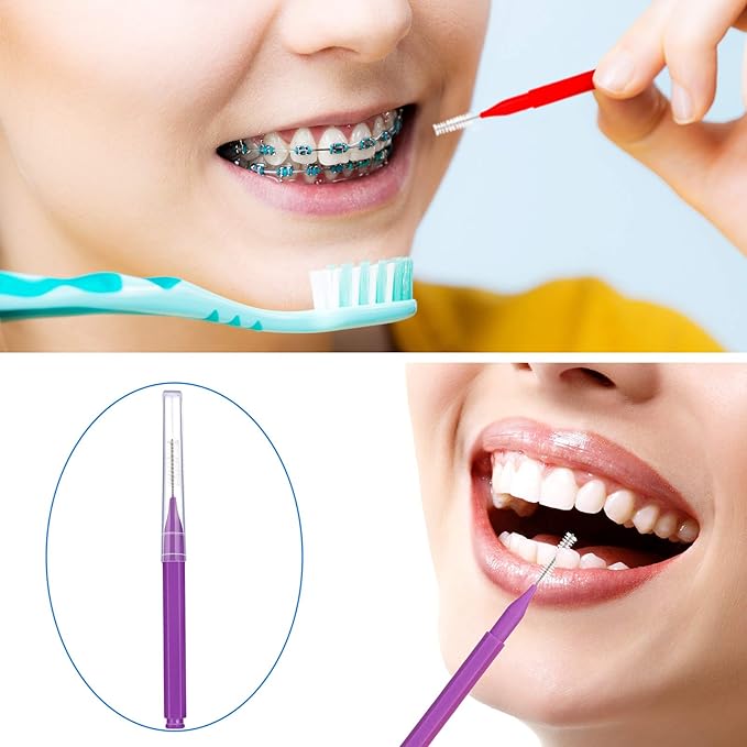 Patelai 100 Pieces Braces Brush for Cleaner Interdental Brush Toothpick Dental Tooth Flossing Head Oral Dental Hygiene Flosser Toothpick Cleaners Tooth Tool