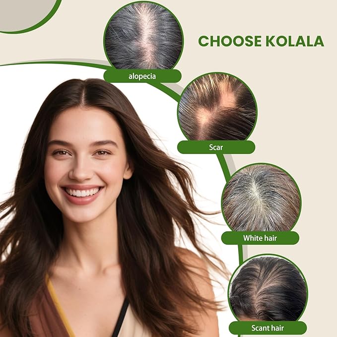 HAIR Toppers for Women Real Human Hair 6x7 inch 150 Density Base 14 inch 65 grams darkest brown Human Hair Topper for Women with Thinning Hair(#2 14inch)