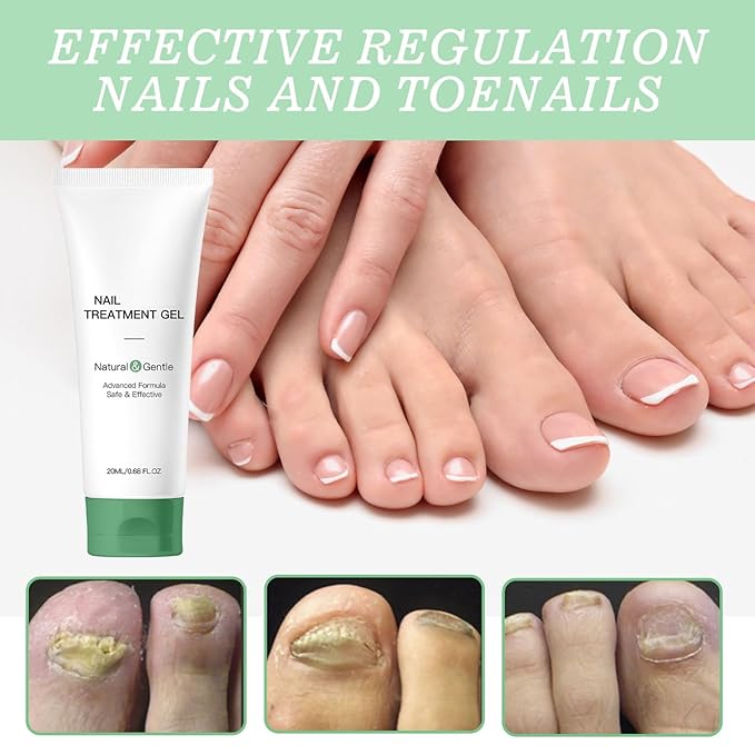 2Pcs Natural Nail Repair Gel, Nail Growth Repair Cream, Multi Purpose Nail Repair Foot Care Cream.