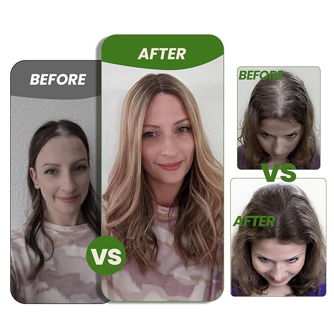 HAIR Toppers for Women Real Human Hair Clip in Silk Base 150 Density 6x7inch 75 grams Jet Black Color 16inch all real huamn hair healthy for Women with Thinning Crown (#1 16inch)