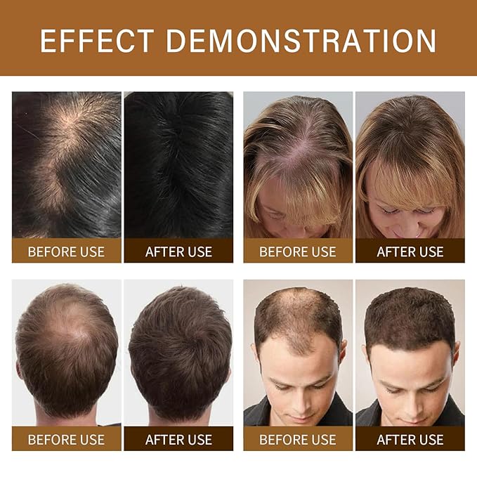 Hair Fibers 27.5g - Fill in sparse hair, instantly making hair thick and voluminous. Suitable for both men and women,Dark Brown