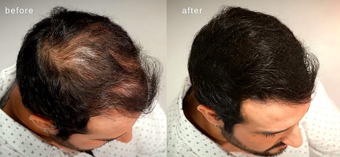 Volumizing Hair Fibers with real Keratin for Thinning Hair/Hair Loss – Dermatologist Tested and Certified Hypoallergenic - 60 days + supply - Multiple Colors Available (Black)