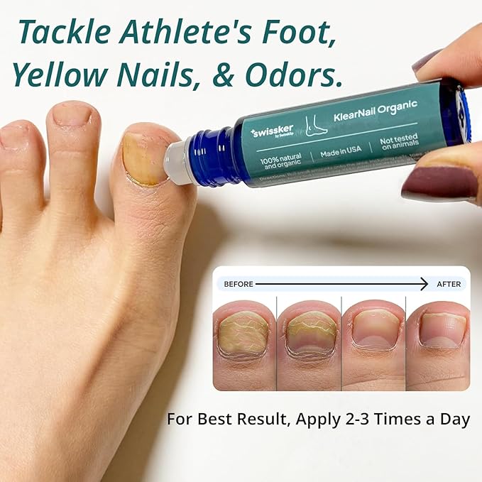 Swissklip Medi-Care Toenail Stick I KlearNail Treatment | Natural Solution for Healthy Nails I Suitable For Foot, Toe, and Fingernail I For Brittle Toenails – 10ml / 0.3 Fl. Oz. Pack 2 - Made in USA