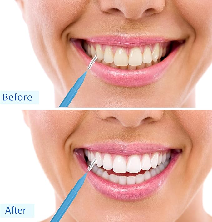 Patelai 100 Pieces Braces Brush for Cleaner Interdental Brush Toothpick Dental Tooth Flossing Head Oral Dental Hygiene Flosser Toothpick Cleaners Tooth Tool(Blue, Grey,Mixed Sizes)